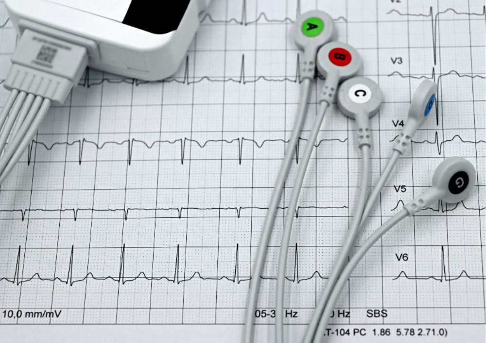ekg holtera monitorešana rīgā klīnikā