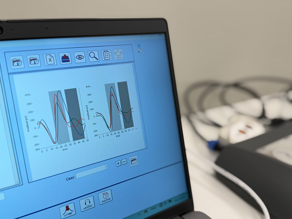 Neirolors-konsultācija