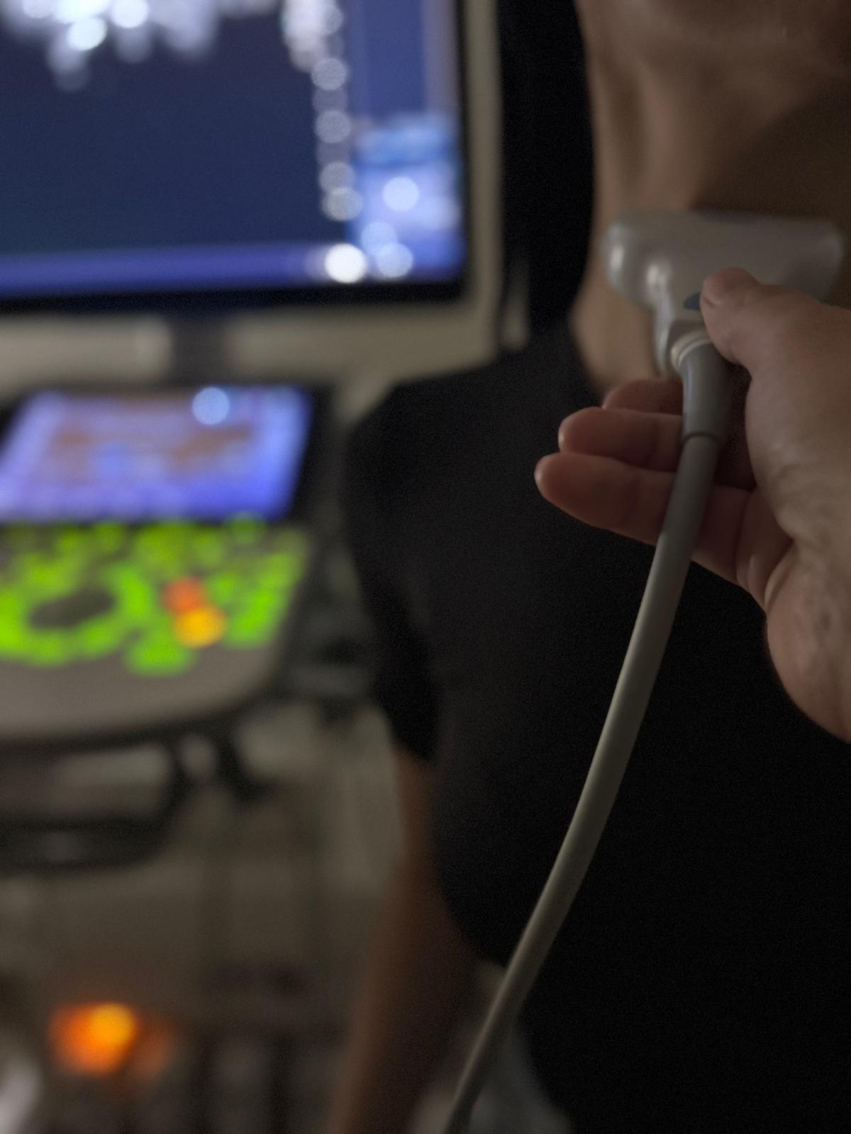 Vairogdziedzera ultrasonogrāfija neiromed plaza pakalpojums (4)