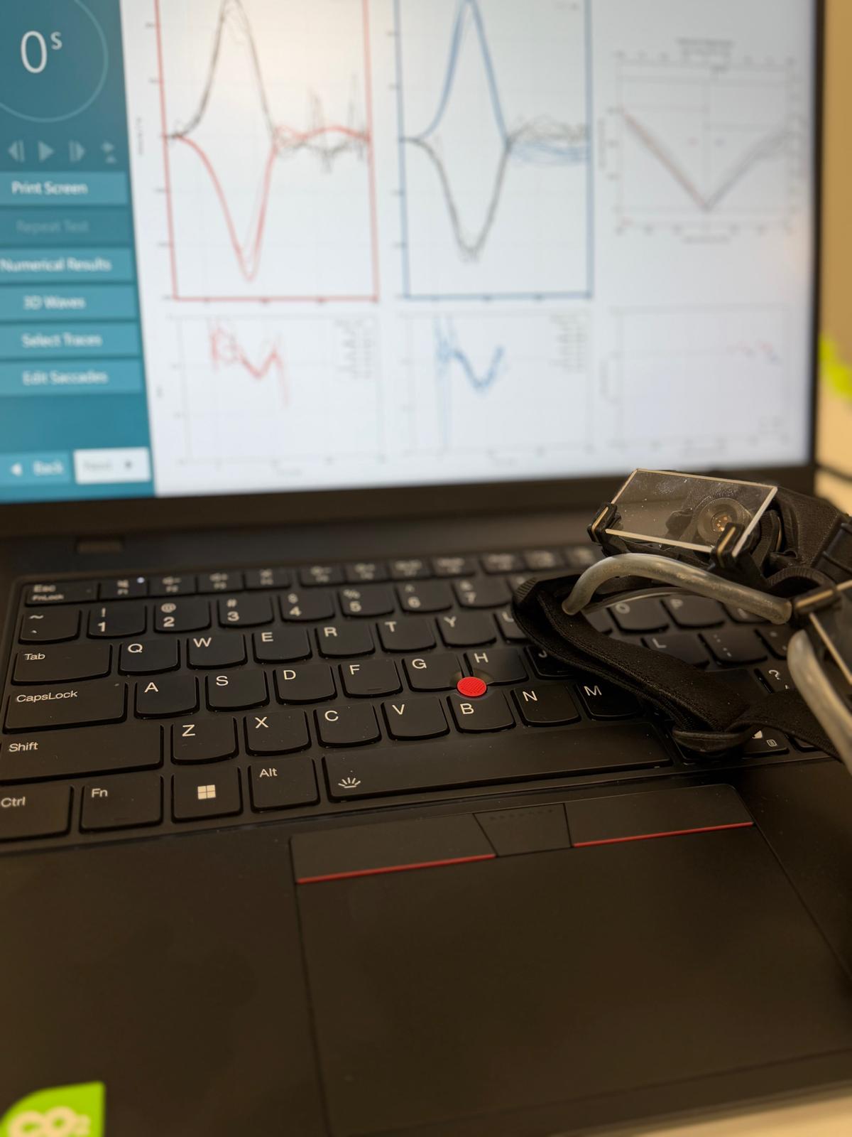 galvas impulsa tests neiromed neiroklīnikā plaza (1)