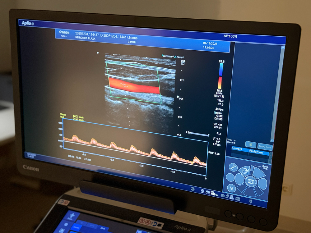kakla-un-galvas-asinsvadu-doplerogrāfija,-dulplex2