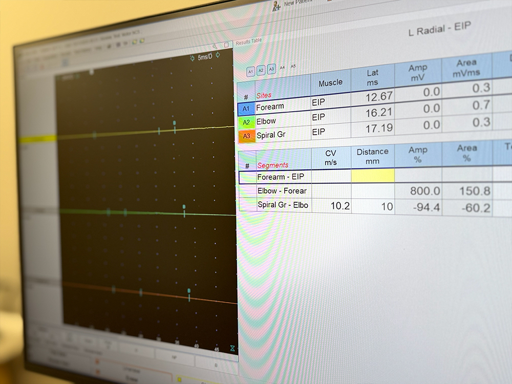 neirogrāfija,-EMG-neiromed-plaza