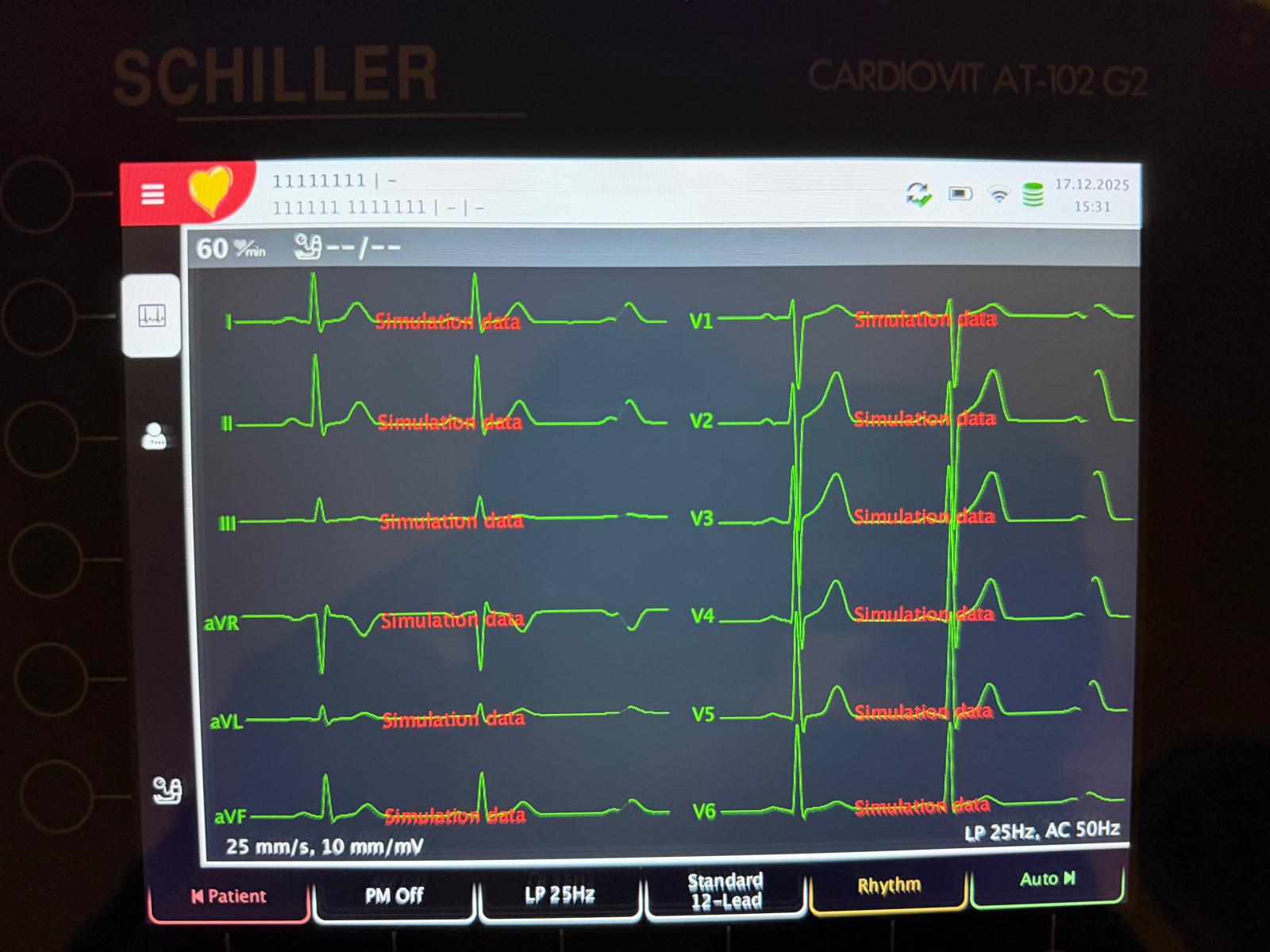 neiromed plaza neiroklīnikas pakalpojums ELEKTROKARDIOGRAMMA (3)
